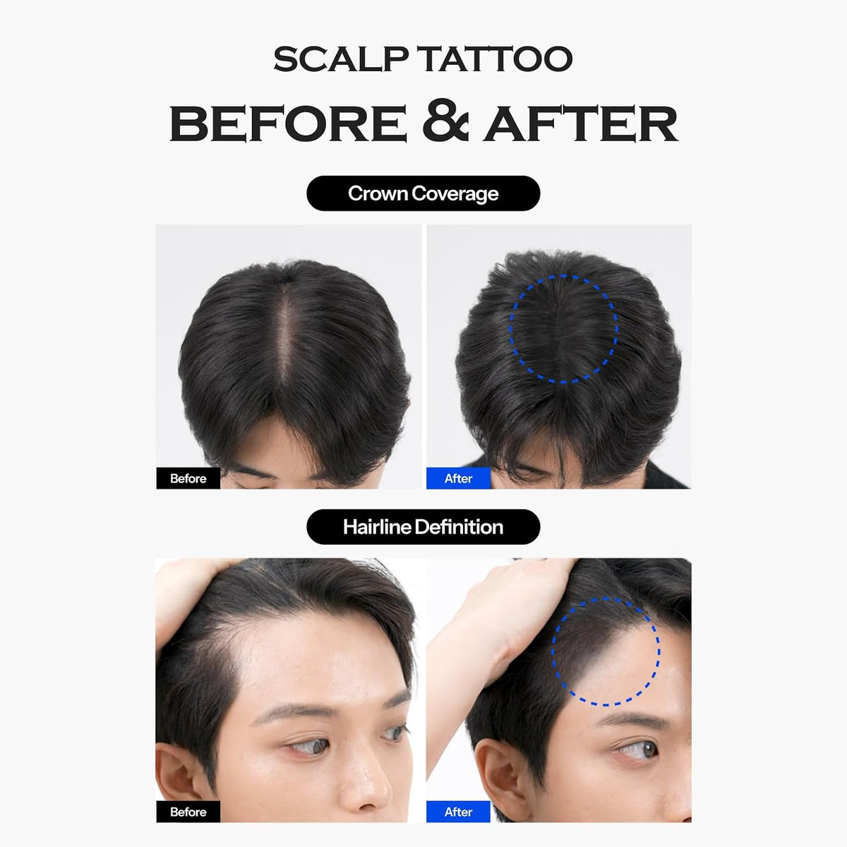 FORBEAUT Scalp Tattoo (Black)