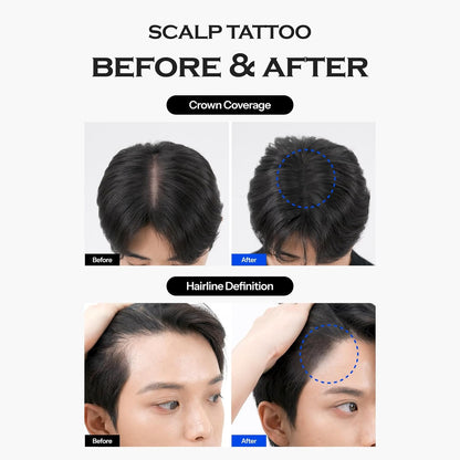 FORBEAUT Scalp Tattoo (Black)