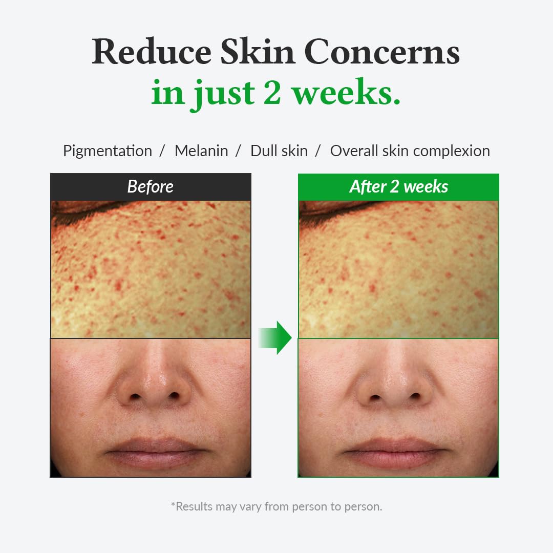 [Damage Box] Dr. Althea Gentle Vitamin C Serum