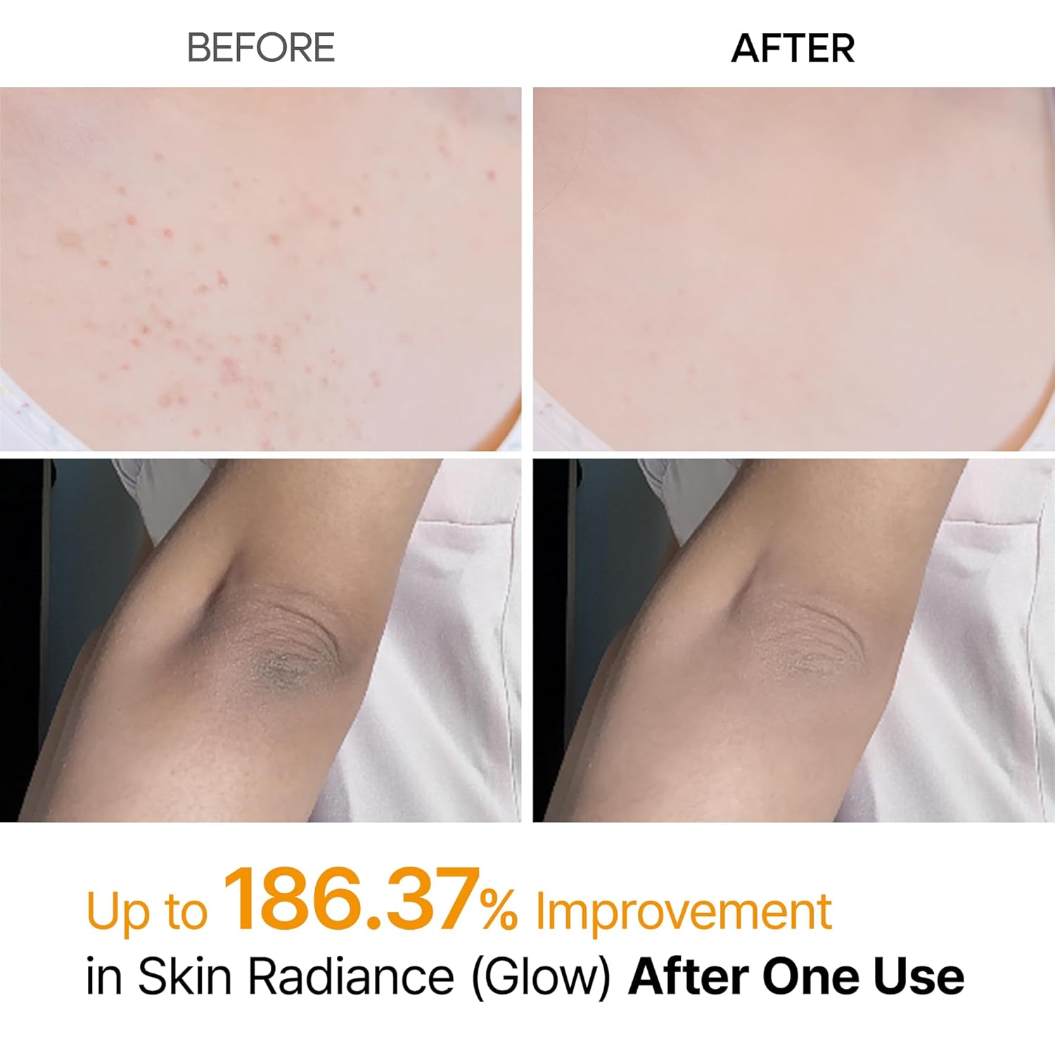[Damage Box] Dr. Melaxin Peel Shot Exfoliating Kojic Acid Turmeric Spray