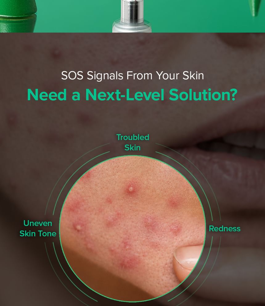 Mary &amp; May Spicule Azelaic PDRN Spot Cream